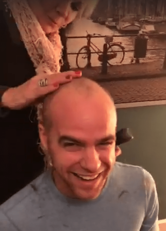 baldhappy